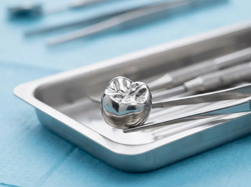 Stainless steel crowns for children's teeth